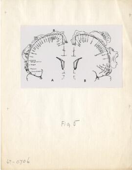 Fig. 17 and Fig. 22 WGP-Rasmussen cerebra 1 cortex of man.