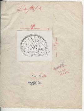 Graphic material used in Epilepsy and cerebral localization (1941)